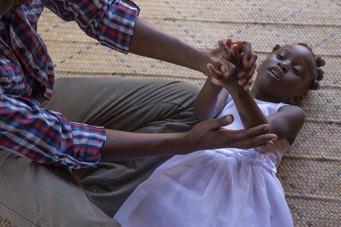 Ein Mädchen aus Malawi macht Physiotherapie. (Quelle: Christian Nusch)